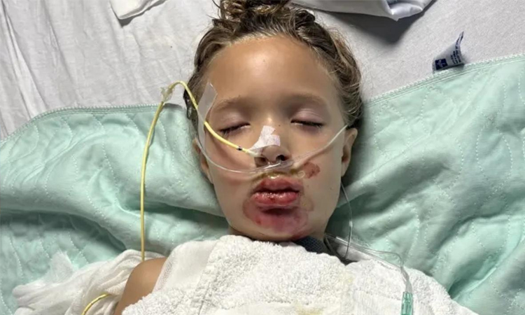 ভাইরাল টিকটক চ্যালেঞ্জের কারণে ৭ বছরের মেয়ে কোমায় চলে গেল ভাইরাল টিকটক চ্যালেঞ্জের কারণে ৭ বছরের মেয়ে কোমায় চলে গেল